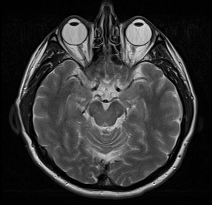 Anatomy on the image
